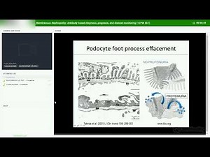 Membranous Nephropathy: Antibody-based diagnosis, prognosis, and disease monitoring