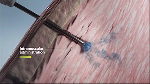 Risperidone ISM (Risvan) – A New LAI for Schizophrenia