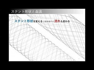 【基礎からよくわかる実践的CFD(数値流体力学)入門】第4章2-C ステントの最適デザインを考える ★☆★Dr. Anzai Presents★☆★