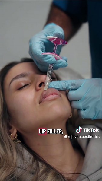 Lip Filler Journey: Dissolving and Refilling Explained