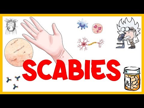 Scabies :- Life Cycle, Pathogenesis, Types, Signs & Symptoms, Risk Factors, Diagnosis & Treatment