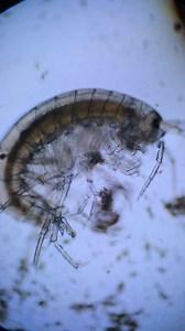 Testing the effects of Potable Aqua water purification tablets on murky pond water under a microscope🔬 #waterpurification #survival #camping #microscope #microorganisms | WoodsBound Outdoors