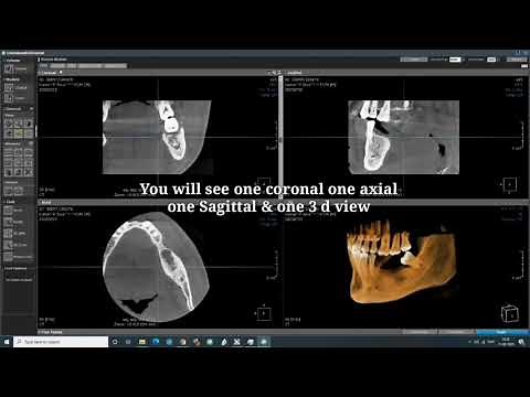 How To Open CBCT Dicom CD.