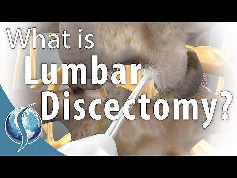 Lumbar Discectomy