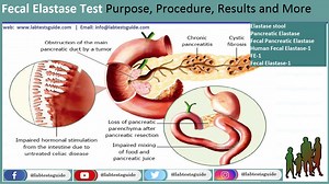 Pancreatic Elastase Test: Purpose, Procedure, and Results - Everything You Need to Know