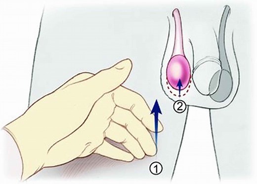 Cremasteric reflex definition & cremasteric reflex test