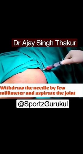 Hip Joint Injection & Aspiration technique