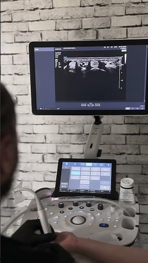 Trigger Finger İnjection with Ultrasound Guidance