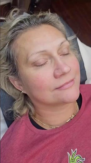Before and After: Microblading Eyebrows