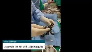 Proximal Humerus Fracture: Percutaneous Reduction and Fixation Technique With Nail