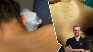 Here's How To Treat A Pinched Nerve