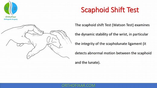 Watson Test | Scaphoid Shift Test Explained Easily | OrthoFixar