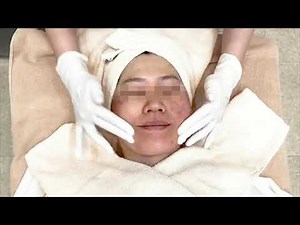 【銀座肌クリニック】マッサージピール施術・症例動画
