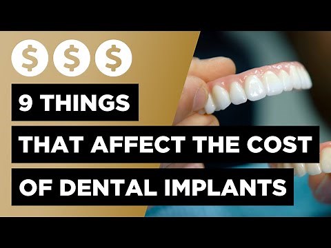 Dental Implants Cost Guide - 9 Factors Influencing What You Pay