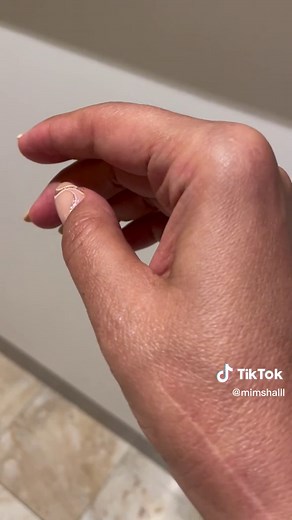 Understanding Involuntary Finger Twitching Causes