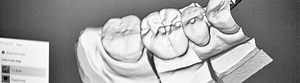 Cad-cam services for dental laboratories | BTK Implanting Trust, Smile Again!