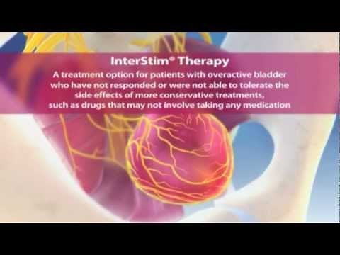 Interstim Therapy Animation
