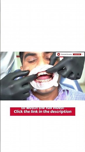 Tips & Tricks for Intra Oral Scanning