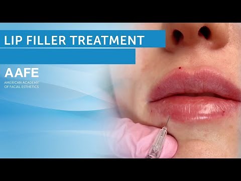 Lip Filler Tutorial