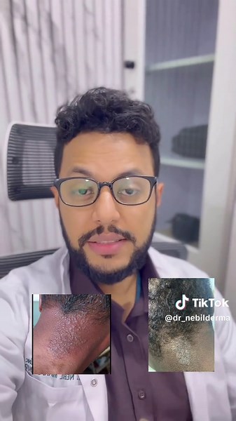 ጭርት? #dermatologist #ethiopian_tik_tok #ethiopian_tik_tok🇪🇹🇪🇹🇪🇹🇪🇹