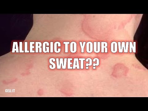 Are You Allergic To Your Own Sweat?? Here’s why….