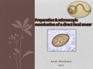 Preparation &amp; microscopic examination of a direct fecal smear - SlideServe