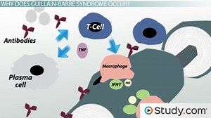Guillain-Barre Syndrome: Sudden Paralysis