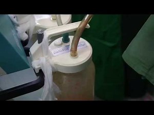 Liposuction - Cosmetic Surgery