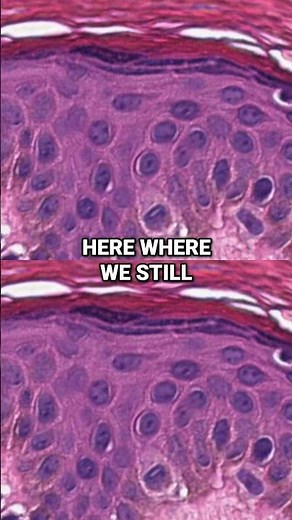 Your Skin Looks Like This (Under The Microscope 🔬)