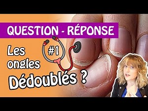 #1 Les ongles dédoublés : D'où ça viens ? Comment les soigner ?