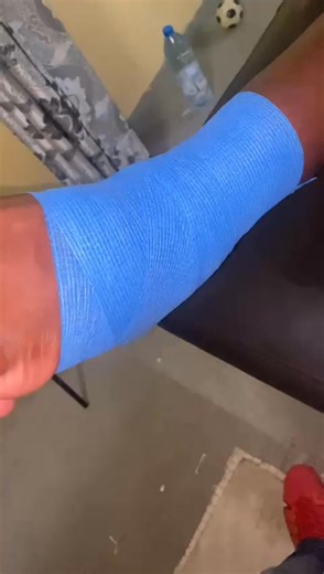 2.2K views · 13 reactions | RÔLE DU KTAPING DANS LA PRISE EN CHARGE...