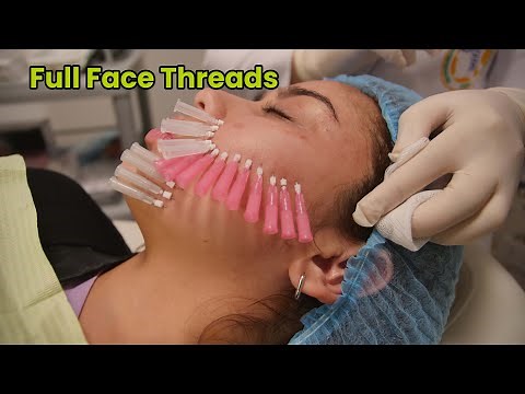 FULL FACE THREADS