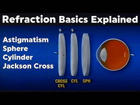 Refraction Explained: How Glasses Work to Correct Vision