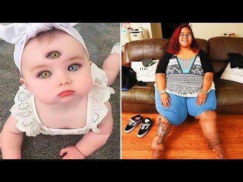 It May Be Hard to Believe, but These 15 People Actually Exist‼️