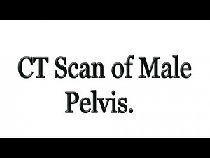 CT scan of Pelvis male