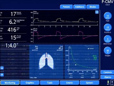 Obtaining Plateau Pressures