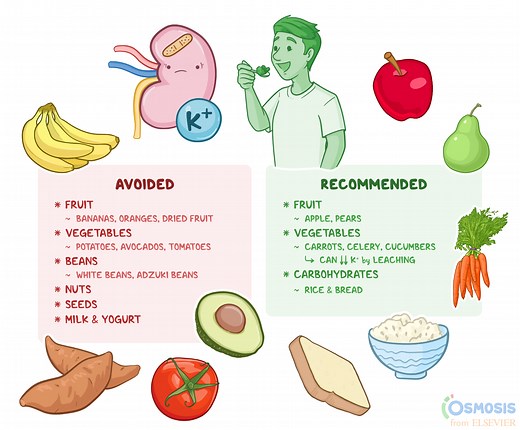 Low Potassium Diet: What Is It, Uses, Foods to Avoid and Include | Osmosis
