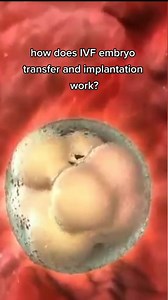 How does ivf embryo transfer and implantation work ? #ttc #ivf #infertilitywarrior #infertilityjourney #ivfwarrior #goldcoastivf #ivfjourney #embryoyotransfer #fertilization #embryo #egg #uterus #women #infertilityjourney #infertilitywarrior #womenshealth #infertilityawareness #infertilitysupport #implantation | Steven Palter