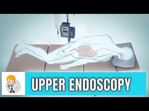 Upper GI endoscopy: Esophagogastroduodenoscopy (Animation 3D)