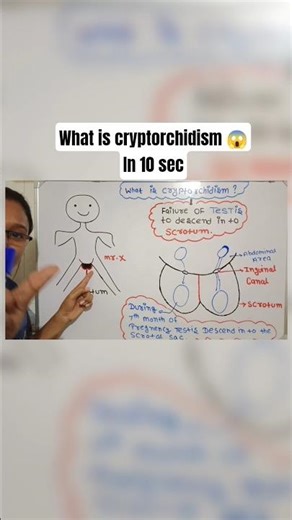what is cryptorchidism 😱?#ytshorts #biology #neet #ncert #viral #shorts #shortsviral #cbse