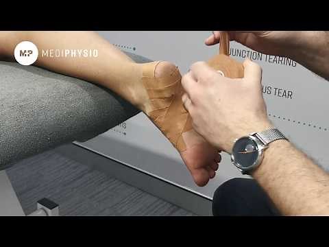 LOW-DYE TAPING TECHNIQUE