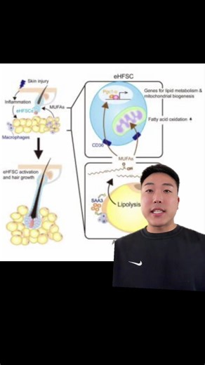 A new study suggests that the tiny fat cells under your scalp might actually help regrow hair. The research comes from a 2025 paper titled “Adipocyte lipolysis activates epithelial stem cells for hair regeneration through fatty acid metabolic signaling.” The idea is that when these fat cells break down some of their stored fat—a process called lipolysis—they release natural fatty acids like oleic acid. These fatty acids act like “wake-up signals” that travel to dormant hair-follicle stem cells. 