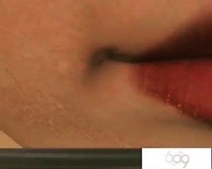 Root Canal Procedure In 3D | Dr.Sreenath S