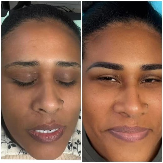 Soft Powder brows🔥🔥🔥 Powder brows, also called Ombre Brows or Shaded Brows, is a semi-permanent makeup technique that creates a soft, powdered effect similar to makeup or brow tint. Instead of individual hair strokes (like microblading), tiny pixels of pigment are deposited into the skin, giving a natural but more defined look. ✨ Benefits: • Soft, shaded effect (like brow powder or pomade). • Long-lasting (up to 2–3 years with touch-ups). • Less invasive than microblading. • Suitable for all 