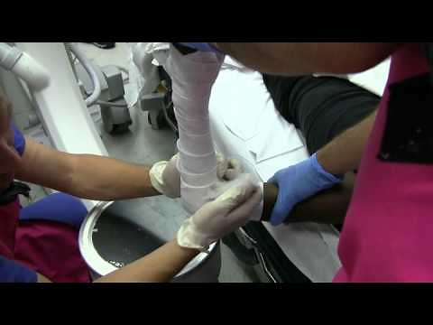 Forearm Fracture Reduction