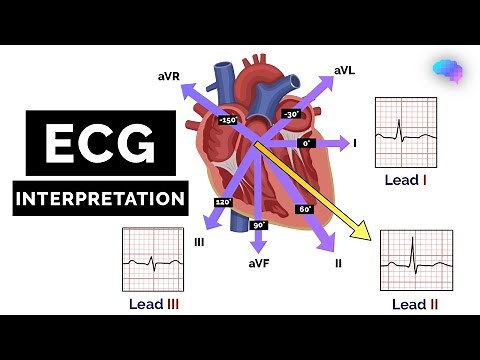 How to Read an ECG | ECG Interpretation | EKG | OSCE Guide | UKMLA | CPSA | PLAB 2