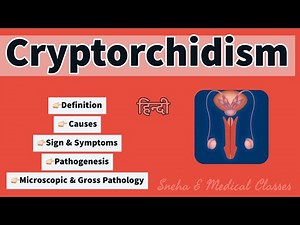 Cryptorchidism !! Pathology !! Microscopic and Gross Pathology !! Pathogenesis !!