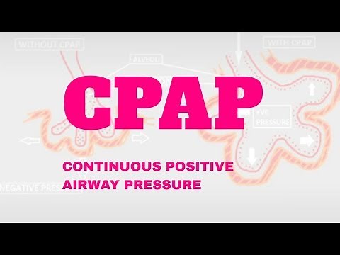 How does CPAP machine work? Continuous Positive Airway Pressure | Diagnotherapy