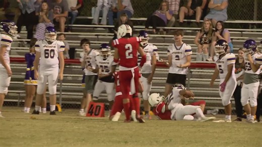 Signs and symptoms of a concussion | Here's what you need to know