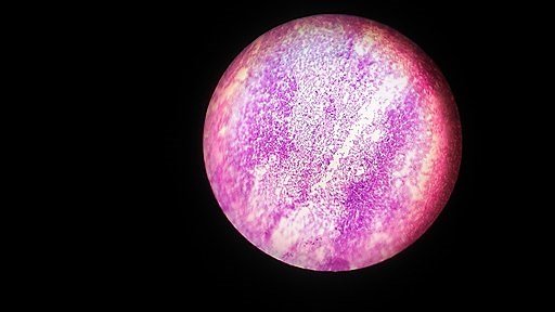 E. Coli under the Microscope -Types, Techniques, Gram Stain, Hanging Drop Method